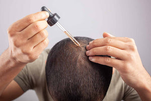 minoxidil_foligain_lotion_5